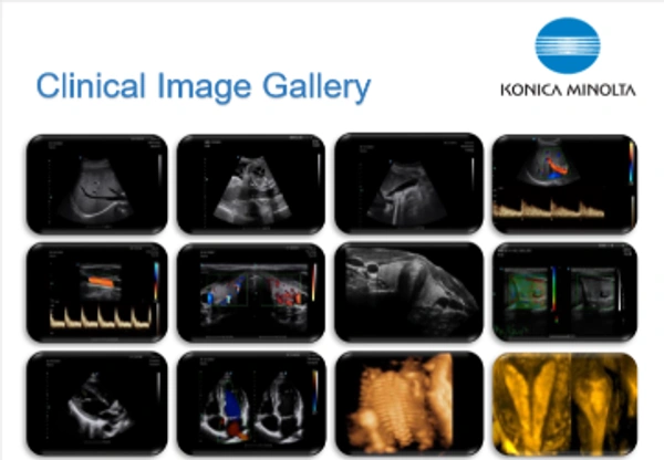 Konica Minolta 3D-4D Color Doppler Konica Model AeroScan CD-35 - Static